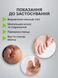 Фіксатор мізинців для корекції пальців ніг для мізинця силіконовий від натирання роздільник