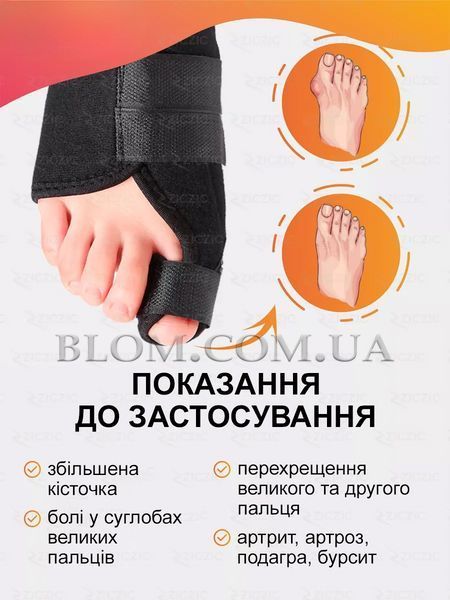 Вальгусні шини від кісточки на великому пальці ніг ортопедичні коректори при деформації стопи