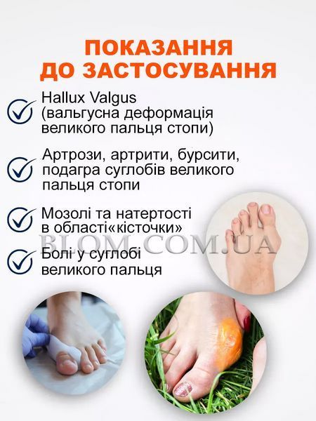 Вальгусный корректор большого пальца стопы при деформации силиконовый фиксатор на кость
