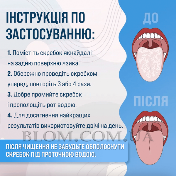 Металевий скребок двосторонній для гігієни порожнини рота 790 фото