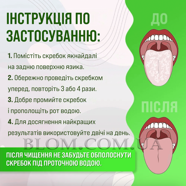 Металевий скребок двосторонній для гігієни порожнини рота 790 фото